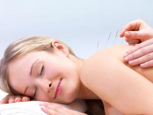 WHY YOU MAY WANT TO TRY DRY NEEDLING BEFORE ACUPUNCTURE